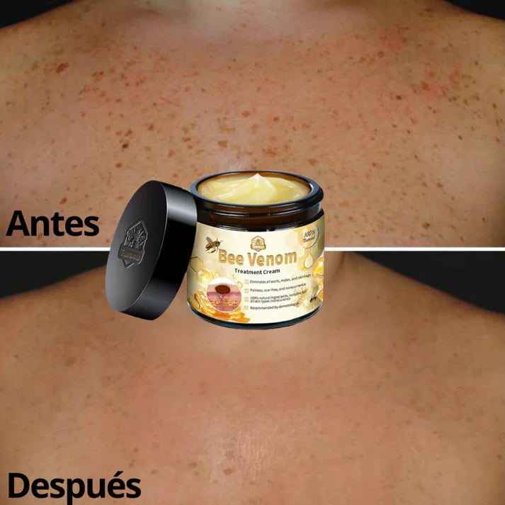 CREMA DE TRATAMIENTO BEE VENOM BSWELL