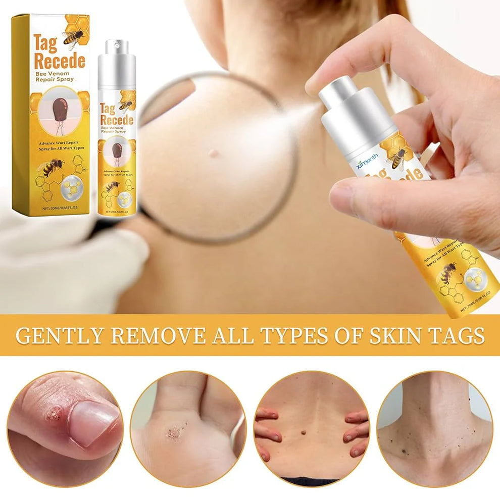 Eliminador de Verrugas Tag Recede® Original - Últimas 7 Unidades 🔥