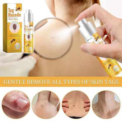 Eliminador de Verrugas Tag Recede® Original - Últimas 7 Unidades 🔥