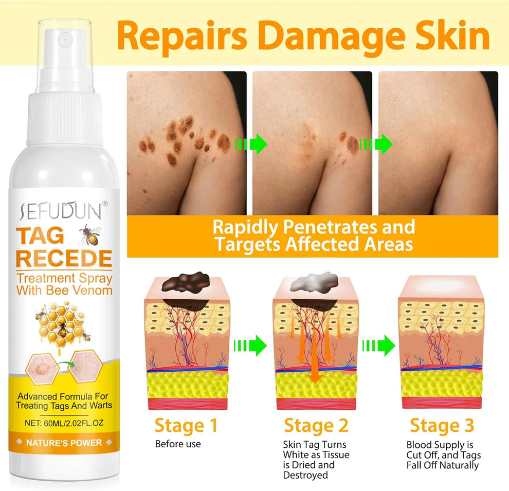 Eliminador de Verrugas Tag Recede® Original - Últimas 7 Unidades 🔥